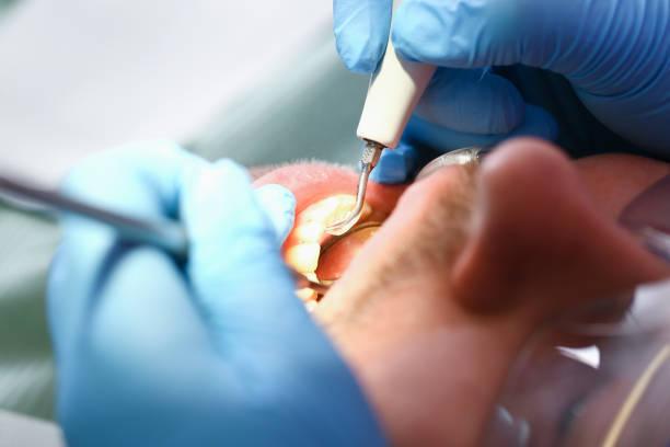Best Emergency Dental Care for Trauma or Injury in Sleepy Hollow, NY